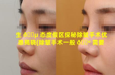 生 🐵 态度假区探秘除皱手术优惠揭晓(除皱手术一般 🌺 需要多少钱贵不贵)